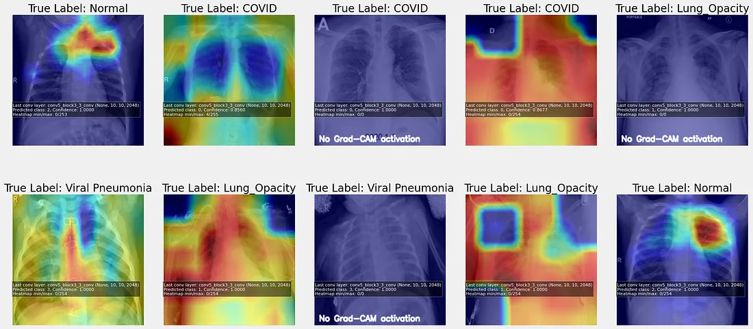 Featured image for Detecting COVID-19 from Chest X-rays: A Deep Learning Approach using ResNet50V2 with Grad CAM article