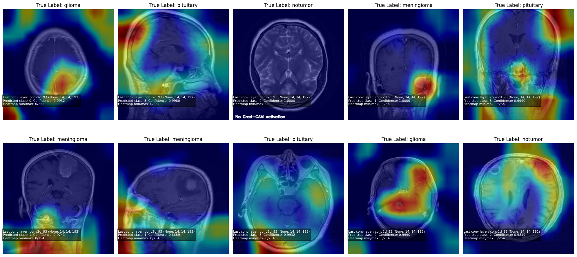 Screenshot of Brain-Tumor-Classification-with-Grad-CAM project